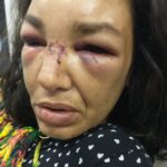 Guarda Municipal que agrediu a mulher em Cabo Frio, RJ, é preso dois meses após o crime