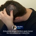 Estudante dirigiu 300km após tomar tiro na cabeça em Cabo Frio