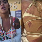 Assessora trans de vereadora de Niterói é agredida por cinco homens na madrugada deste domingo em Cabo Frio
